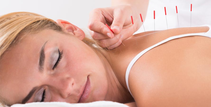 Acupuncture and TCM
