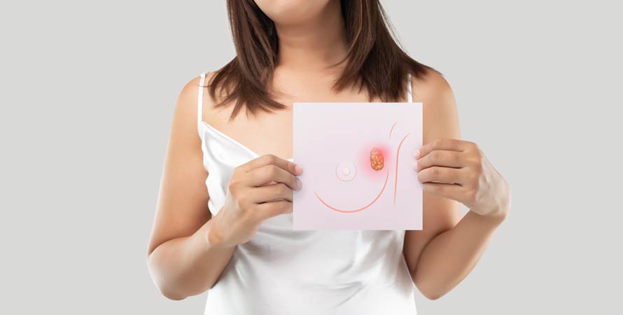 Forms of breast cancer