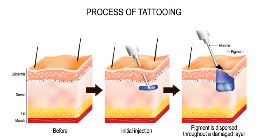 Skin dangers of tattooing