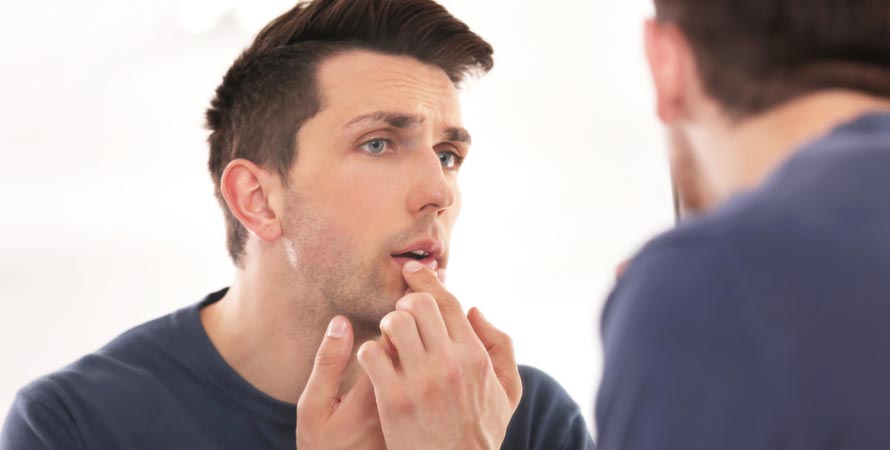 Cold Sores Contagious