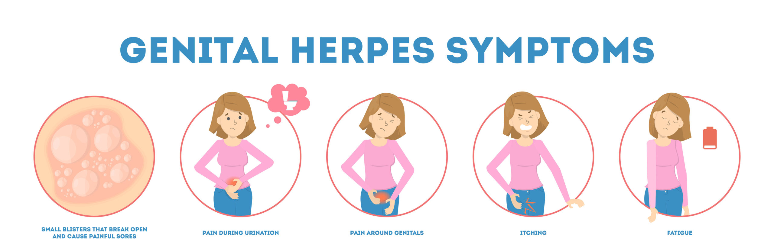 Genital Herpes