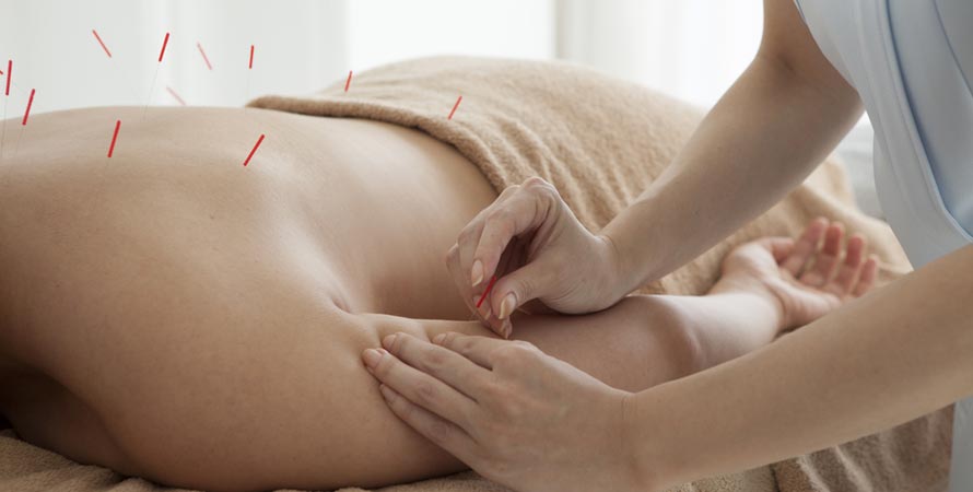 Acupuncture is an effective