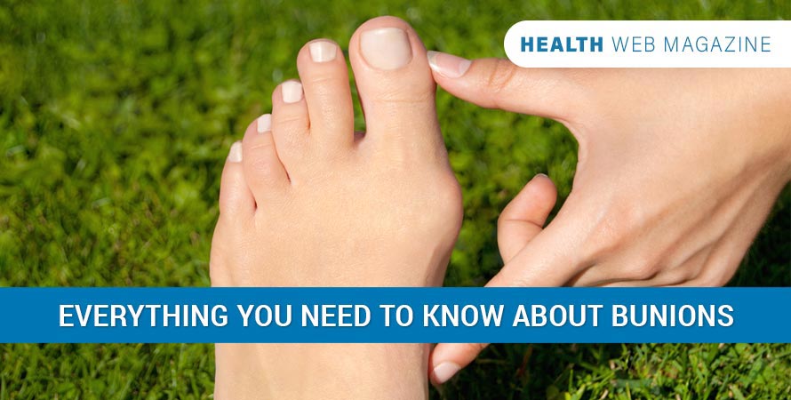 Bunions