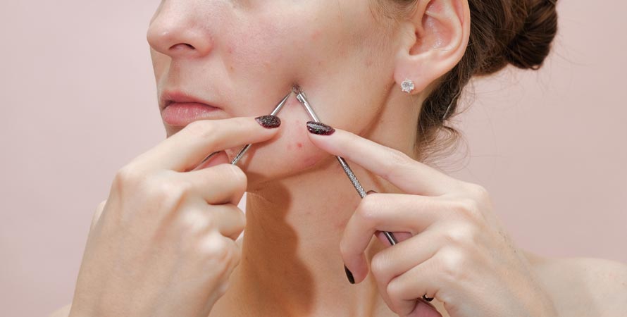 Dangerous Methods To Remove Blackheads