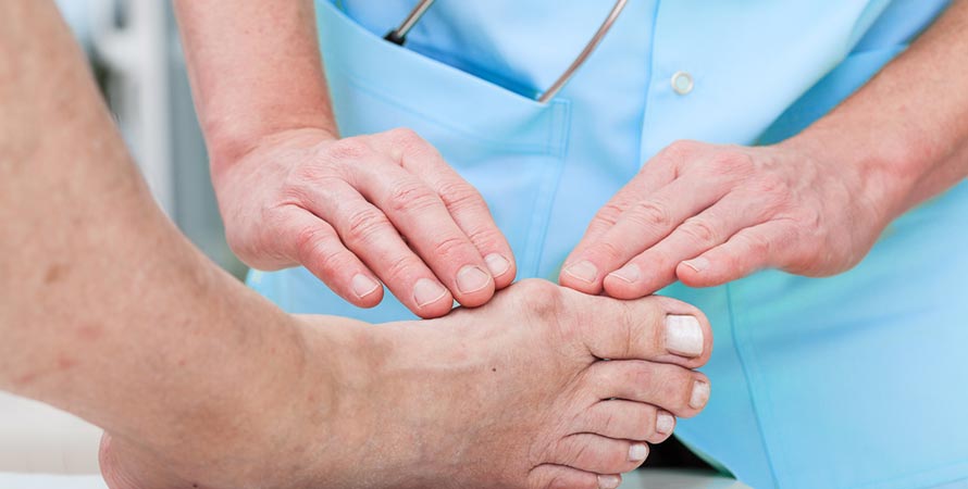 Fix bunions