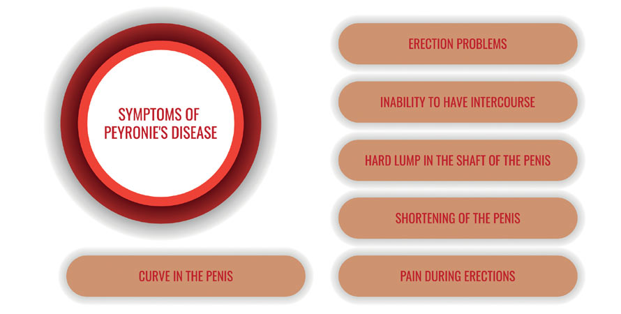 Symptoms Of Peyronies