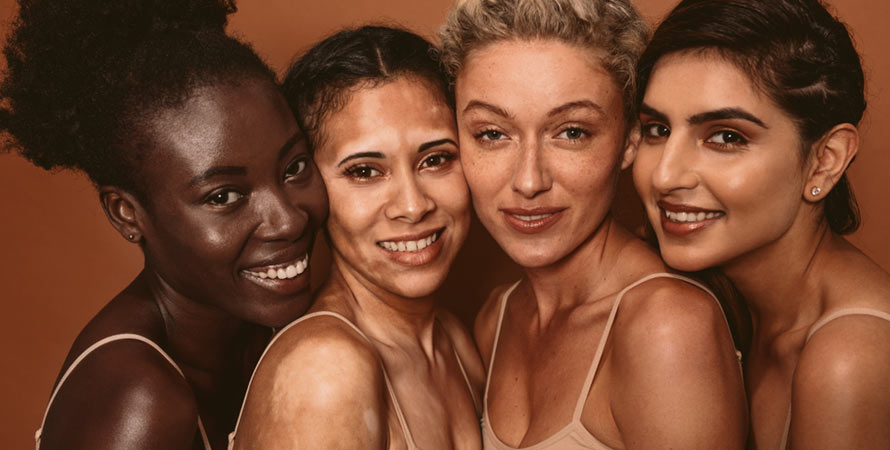 Acquiring Vitiligo