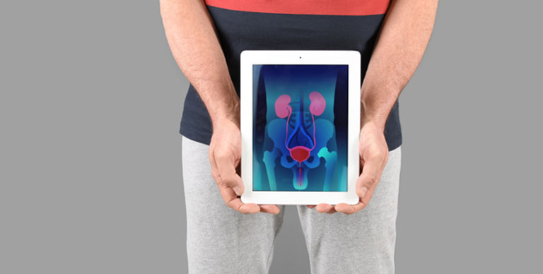 Prostate Calcification