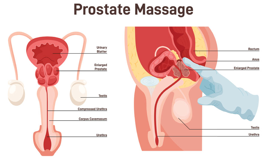 Prostate massage