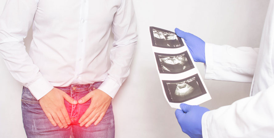 Prostate