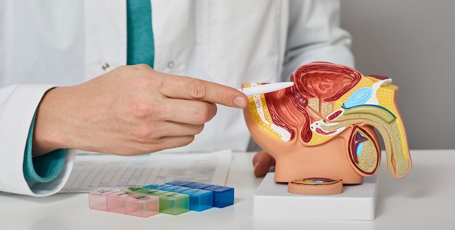 Prostate Removal
