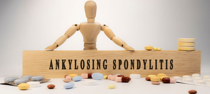 Ankylosing Spondylitis