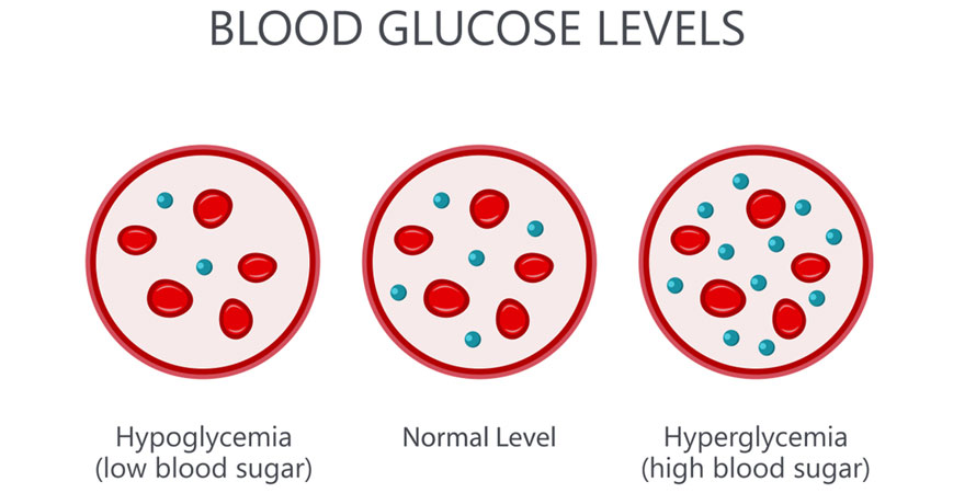 Blood Sugar Level