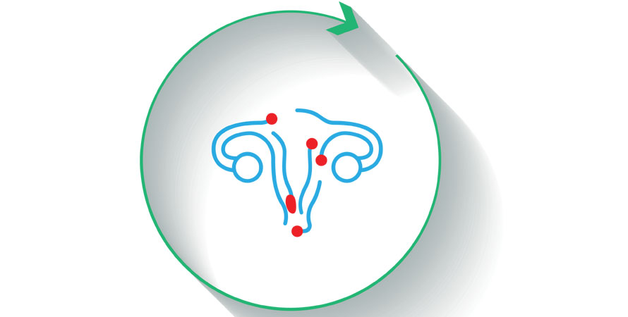 Vaginal rejuvenation work