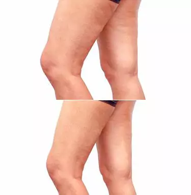Cellmaxa Before After