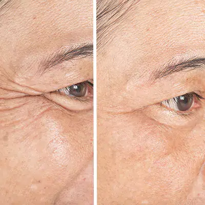 before-after