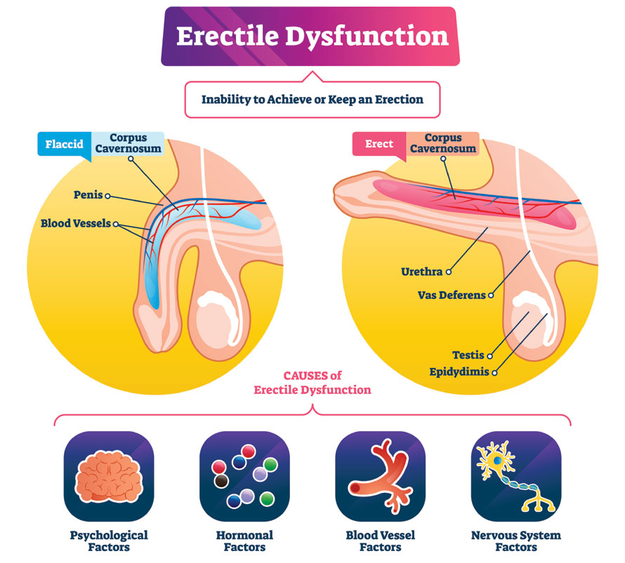 Erectile dysfunction
