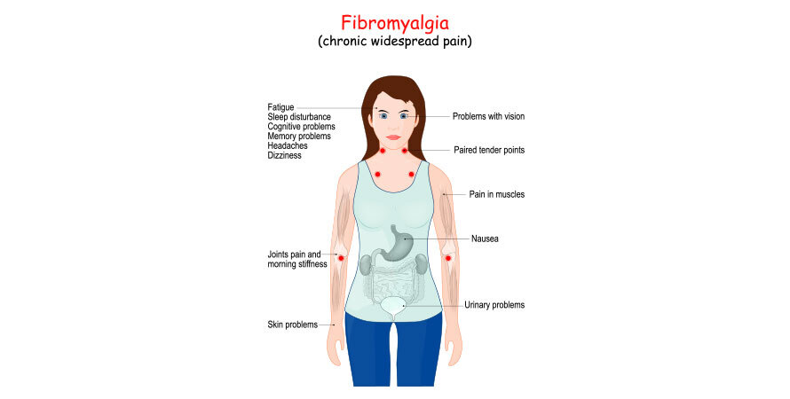 Does Fibromyalgia Cause Joint Pain? Fibromyalgia-Related Pain Explained