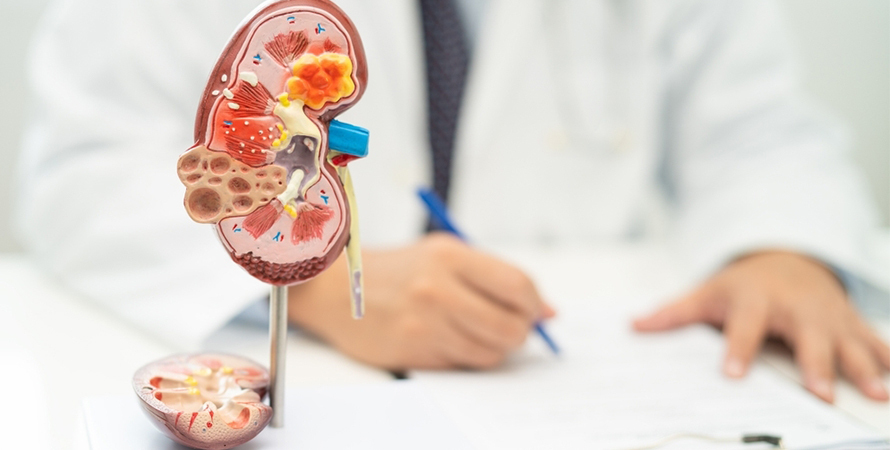 Kidney Pain Location: Where It Hurts, What It Feels Like, and When to Worry