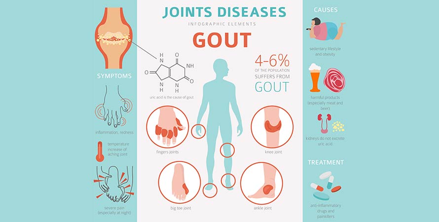 Symptoms of Gout