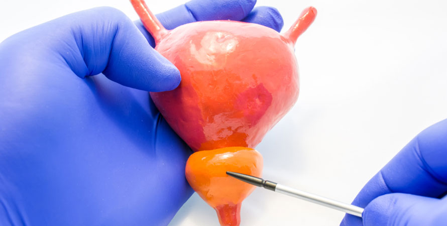 bladder and prostate