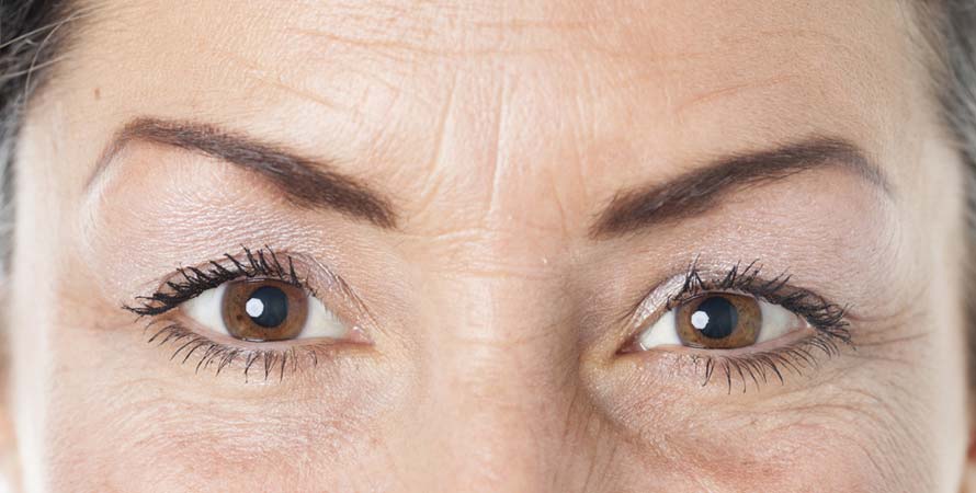 Causes of Skin Wrinkling