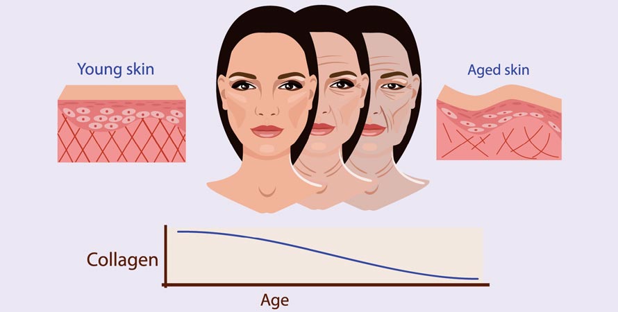 Collagen Production