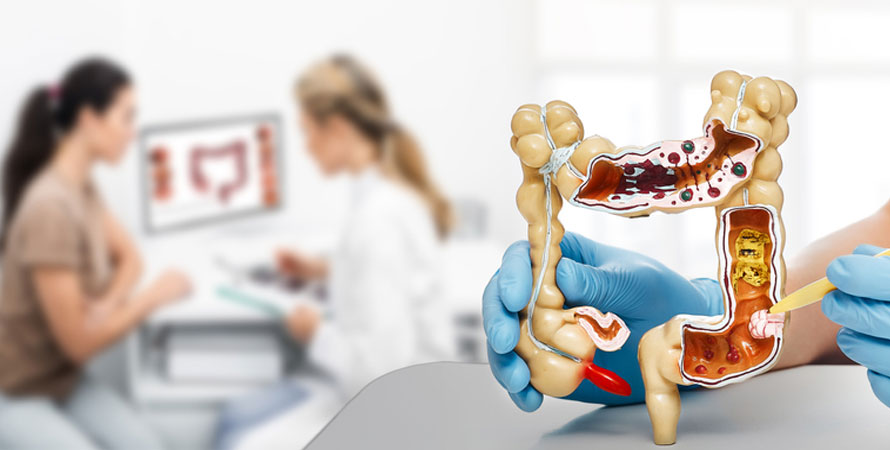 Colon System
