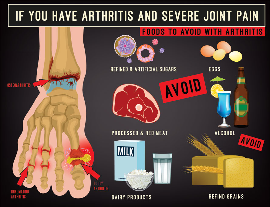 Foods to avoid for osteoarthritis