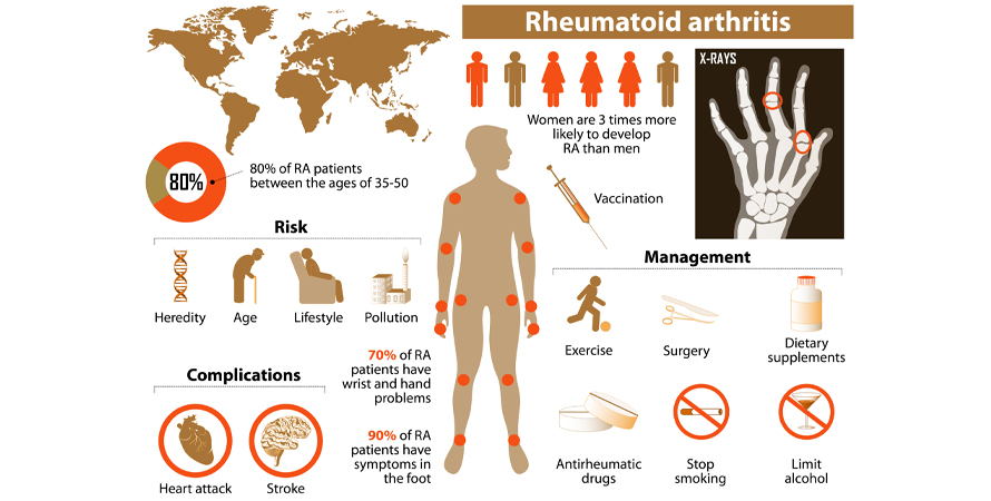 Rheumatoid arthritis