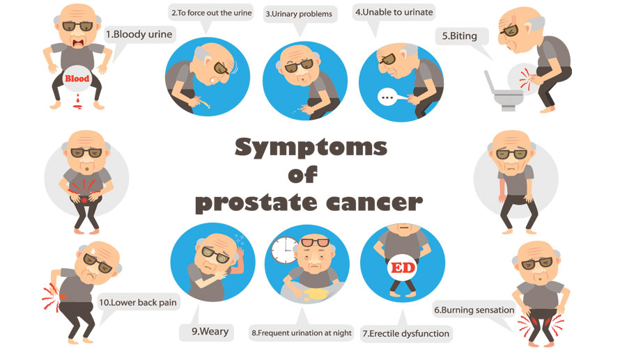 signs and symptoms of prostate cancer
